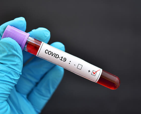 5 Quick Tips for Navigating COVID-19 Coding