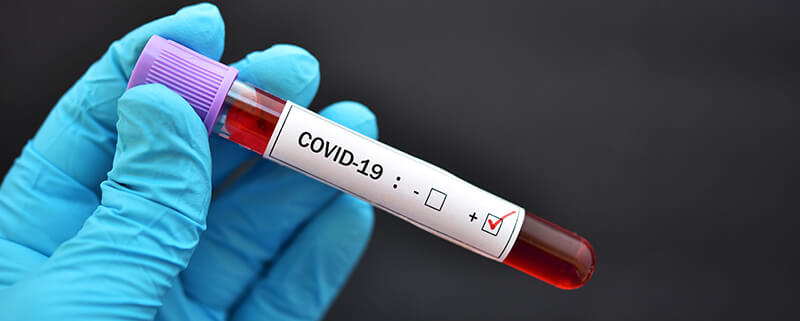 5 Quick Tips for Navigating COVID-19 Coding